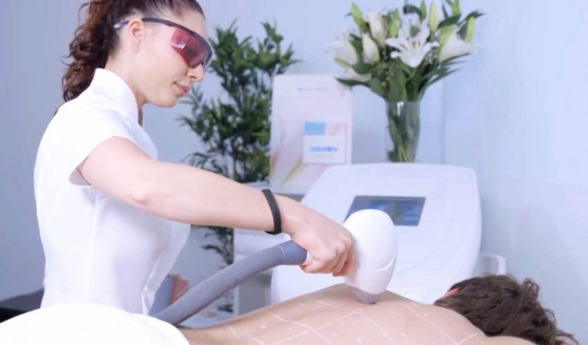 How long is a Laser treatment?